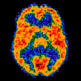 Brain Imaging